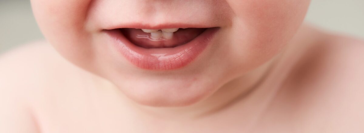 دندان شیری| هدی دنت