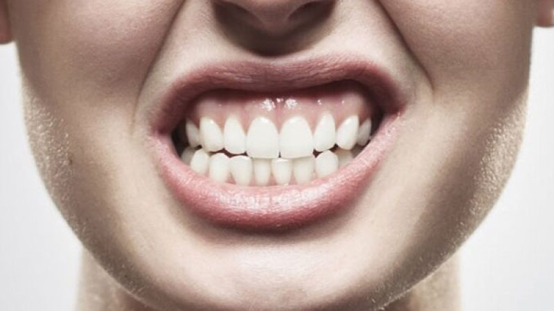دندان قروچه| هدی دنت