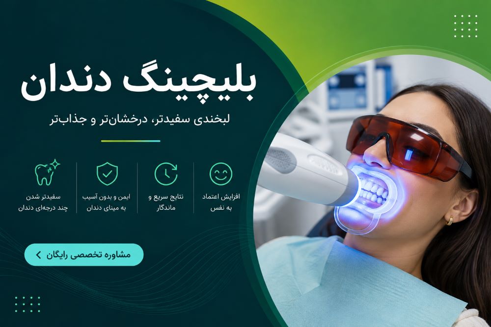 بلیچینگ دندان در کلینیک هدی دنت یزد