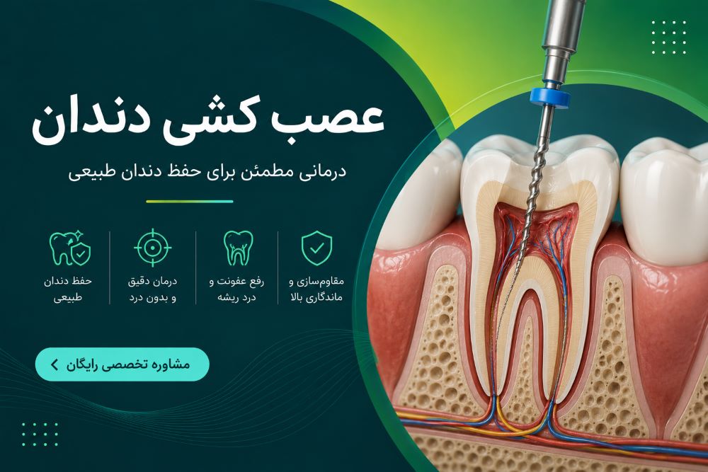 عصب کشی دندان در یزد در کلینیک دندانپزشکی تحت بیهوشی هدی دنت