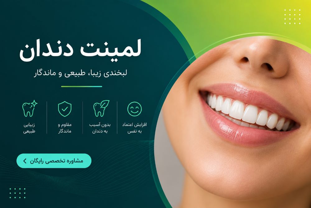 لمینت دندان در کلینیک هدی دنت یزد