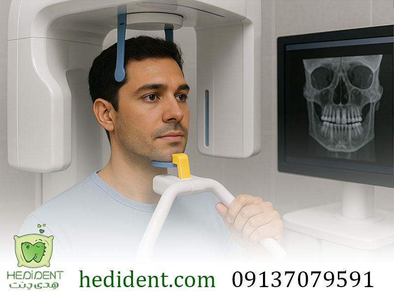 تصویربرداری CBCT دندان