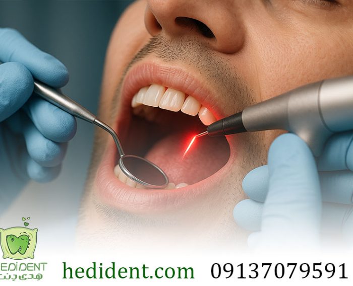 دندانپزشکی با لیزر چیست؟