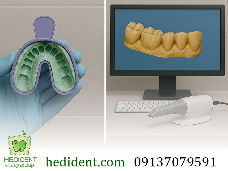 قالب­گیری سنتی و مدرن