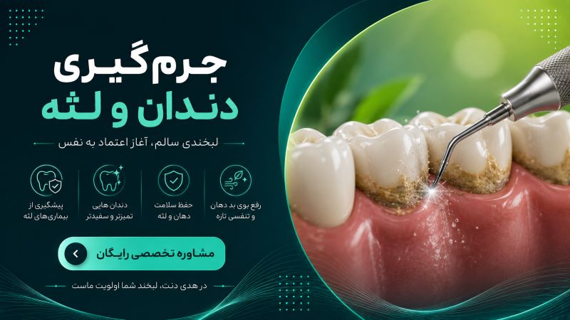 جرم‌گیری دندان و لثه در یزد در کلینیک هدی دنت