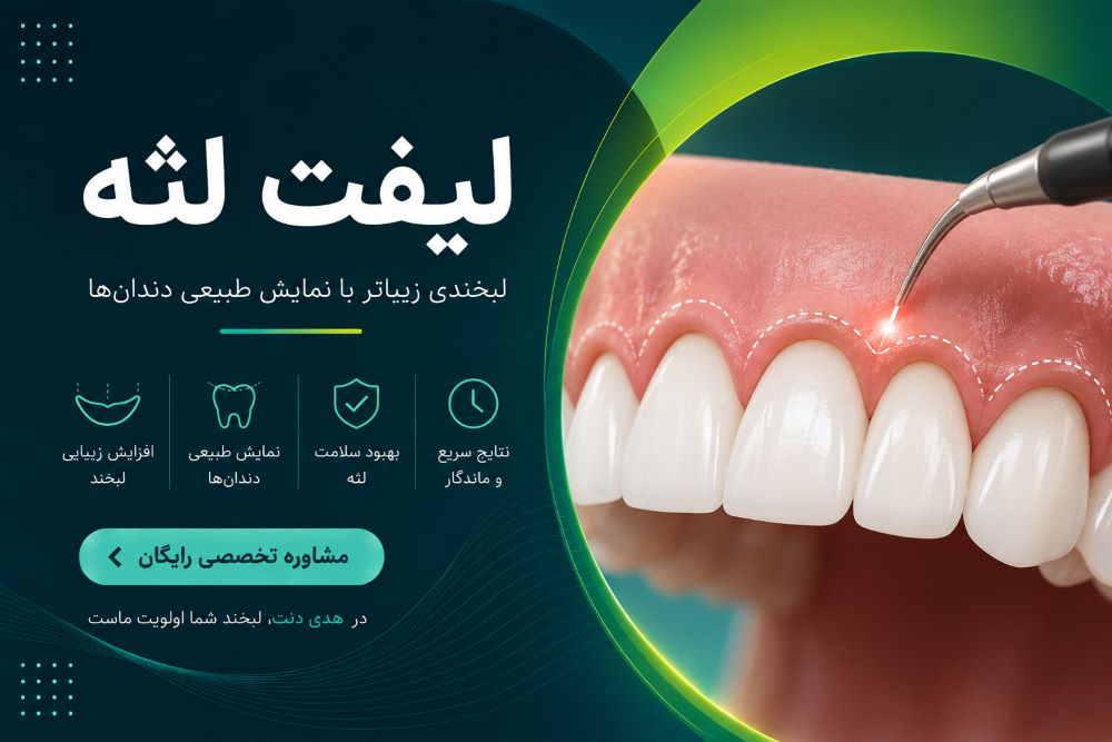 لیفت لثه در یزد در کلینیک هدی دنت