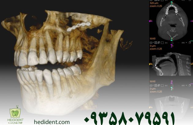عکس CBCT دندان چیست؟