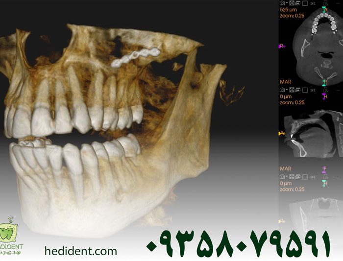 عکس CBCT دندان چیست؟