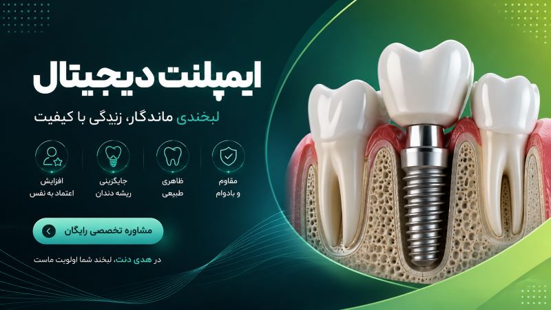 ایمپلنت دیجیتال در یزد در کلینیک هدی دنت