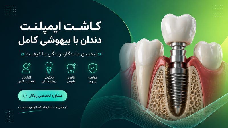 کاشت ایمپلنت دندان با بهوشی کامل